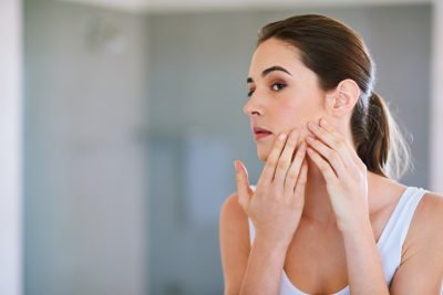 adult-acne-e48.jpg